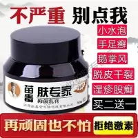鹅掌风手癣膏脚藓真菌感染脱皮干裂水泡湿疹体股廯去根止痒yao膏鹅掌风膏