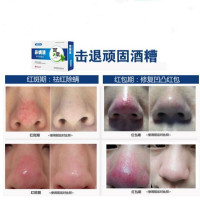 酒糟鼻螨清酒渣鼻修复凝胶螨虫治红鼻子去粉鼻头血丝男女莓鼻子 15g