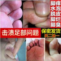 脚痒水泡脱皮烂脚丫止痒膏足藓脚臭脚起水泡脚趾缝开裂烂