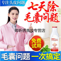 头上长疙瘩头痒滋润头皮头发毛囊洗炎虫止痒控油清洁康王去屑洗发水