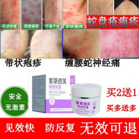 蛇盘丹清膏带状疱疹后遗症缠腰蛇神经痛众芝堂奇方蛇盘疮膏外用