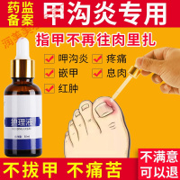 甲沟炎薬软甲脱甲膏薬膏指甲软化剂水去肉芽工具