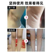 脖子黑洗不干净颈部腋下腋窝大腿根脸部全身去除黑色素沉淀黑颈部腋下臀部大腿根部去除黑色素