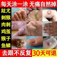 去猴子肉粒疙瘩治刺猴去除猴子刺猴肉手部足部断专用的膏根