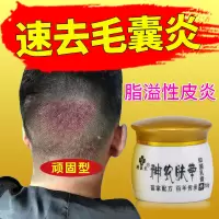 头皮毛1囊炎专用脂溢性1皮炎头背部脓包祛痘红疹瘙痒膏
