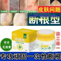 手足三珍清紫椒酊牛皮手足癣藓神经性外用湿疹止痒去根膏