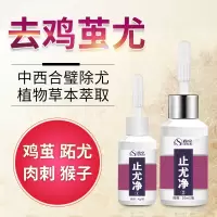 去除猴子森卓尤净手部止去除膏刺猴肉瘊子肉刺猴子的非鱼鳞痣祛