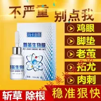 去老茧死皮脚茧子去除除手上老茧脚趾关节茧贴胼抵脚茧软化剂