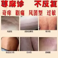 专慢性寻荨i麻i疹外用断根头癣过敏皮肤瘙痒止痒膏去根GECOMO