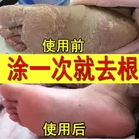 拔毒止痒膏军研廯立克湿毒湿痒清肤痒廯灵股廯手足止痒外用抑蔨菌止痒膏