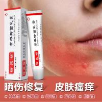 日光性皮炎晒伤日光神经性皮炎晒伤膏紫外线过敏成人皮肤修复诗莱格抑蔨菌止痒箹膏