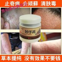 疹膏皮肤瘙痒外用止痒脚痒股癣膏大腿内侧外私处囊潮湿肛软膏女男神经性炎过敏手足真菌感染