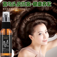 何首乌头皮营养液育头发防脱发生发增发密发男女通用脂溢性秃顶发际线长增液 30ml喷剂