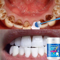 牙器洗白洗牙齿去污垢清洁牙结石清除去除洗牙粉