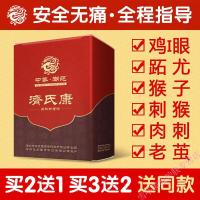 点猴子去疙瘩手鸡尤净跖尤膏止趾康刺猴肉刺瘊子贴去尤灵老茧手足部脚底