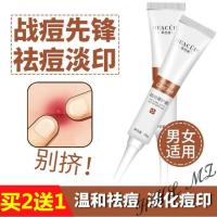 净痘膏净痘点涂凝胶祛痘霜去痘膏男女士祛痘面霜痘痘淡印收缩毛孔凝COBEN