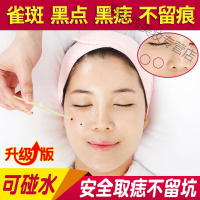 去痣去痦子药伊始金水点斑水雀斑水点痣膏去黑点痦子脸部黑痣去除无痕正品金水