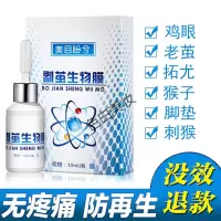 跖疣脚底趾疣剥茧生物膜去膏除脚趾老茧贴瘊子跖疣液脚茧净脚垫脚底