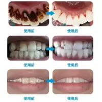牙粉洗牙粉洁牙牙牙齿变白洗白去