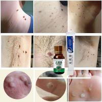 治猴子的yao尤本克疣霜液去疣灵病毒疣瘊去丝状疣趾疣扁皮疣去疣膏瘊子去除