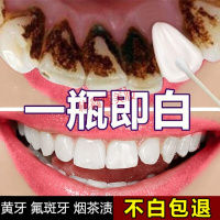 去除牙齿烟渍小苏打粉牙齿速效去除牙烟渍牙垢氟斑牙洗牙液洗牙粉小苏打牙贴神器