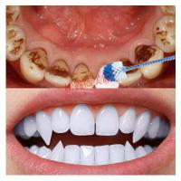 洗牙粉本洗牙粉牙口牙结石牙齿洁牙素牙粉去牙垢