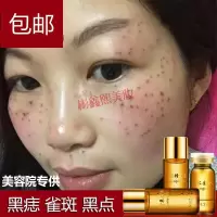 去痣去痦子药伊始金水去痣点痣药水无痕苍蝇屎点斑水取痣去志雀斑痦子