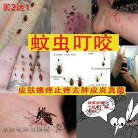 跳蚤膏跳蚤臭褥抗毒虫床虱防蚊子蚂蚁叮咬消红肿皮肤炎外用瘙痒止痒膏