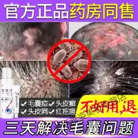 毛囊炎洗发水专用药去螨虫洗发水头皮毛囊炎洗发水头痒头皮去屑止痒