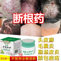 头上长疙瘩去毛囊脂溢性头皮肤炎头皮头部脓包疮毛囊皮肤炎牛皮头皮癣膏