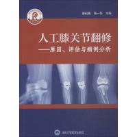 人工膝关节翻修--原因评估与病例分析