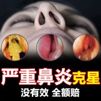 鼻炎膏过敏性鼻炎膏慢性鼻息肉鼻甲肥大鼻窦炎打喷嚏鼻塞治M6