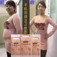 减肥燃脂瘦身轻松瘦8-30斤减肥产品器材肚脐贴瘦肚子瘦大腿手臂W1