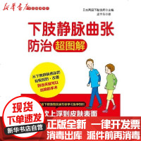 [新华书店]正版 下肢静脉曲张防治超图解两国下肢诊所中国纺织出版社9787518073962 书籍