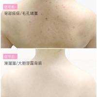 [2盒装]乳木果身体磨砂膏去角质死皮面部全身去鸡皮肤清洁毛孔毛囊疙瘩大腿背部养护理嫩肤