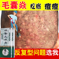 头上长疙瘩头上长疙瘩毛囊有炎头皮有痘痘背部私处专用头部疮