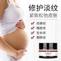 舒佗孕妇产后护理抚痕精华霜修护妊娠纹霜 妈咪修护精华霜50g