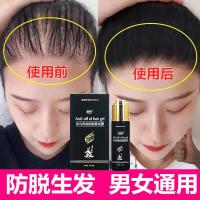 毛基质营养液发教授液小黑瓶增长液抖音同款增发密发奇记育头发精华液男女防发秃顶健发固发