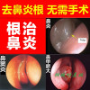苗要鼻炎膏过敏性鼻炎膏鼻窦炎鼻塞苗家鼻甲肥大苗克星鹅不食草