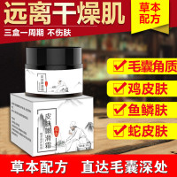 去鸡皮霜祛除鱼鳞皮蛇皮祛除毛周毛囊角质化疙瘩皮肤嫩滑肌肤修护霜