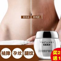 去修复霜紧致收腹妈咪修护精华霜妊娠去修复霜产后消除紧致孕妇妊辰纹肥胖纹大腿生长纹
