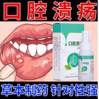 佰沐康口腔溃疡溃烂喷剂复发性口舌生疮嘴巴上火起泡喷上火口疮牙龈发炎肿痛嘴唇溃烂口腔异味喷剂