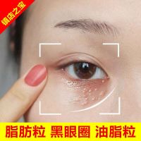 [拍2送1]小夫巧安去脂肪粒眼霜扁平尤祛除汗管溜黑眼圈眼袋膏眼部精华液男女