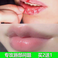 云南本草唇愈膏唇炎膏润唇膏口角修复嘴唇部干裂开裂脱皮护理烂嘴角痒炎起泡男女儿童护唇裂膏