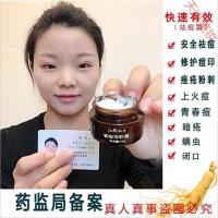 极尚祛痘霜名膜大黑瓶祛痘祛痘印痘坑安肌修复李佳琦祛痘膏