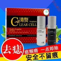 祛痣无痕膏点痣水脸部去點水防疤家用點猴子去肉痣藥水清赘 祛痣无痕膏点痣水