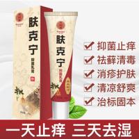 肤克宁乳膏腾威肤克宁抑止痒乳膏治癣皮肤手脚股藓私处瘙痒外用膏