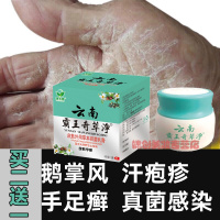 鹅掌风膏手癣膏真菌感染鹅掌风手足癣藓汗疱疹止痒去干裂脱皮膏