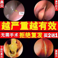 四季鼻炎膏中薬苗家土方鼻1窦炎鼻甲肥大苗药濞炎膏