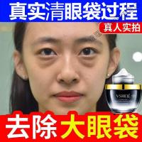去眼袋訷器-眼霜黑眼圈细纹紧致消浮肿祛脂肪粒泪沟克星正品